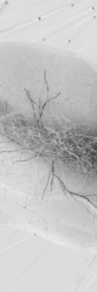Neuro